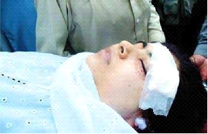 malala yousafzai